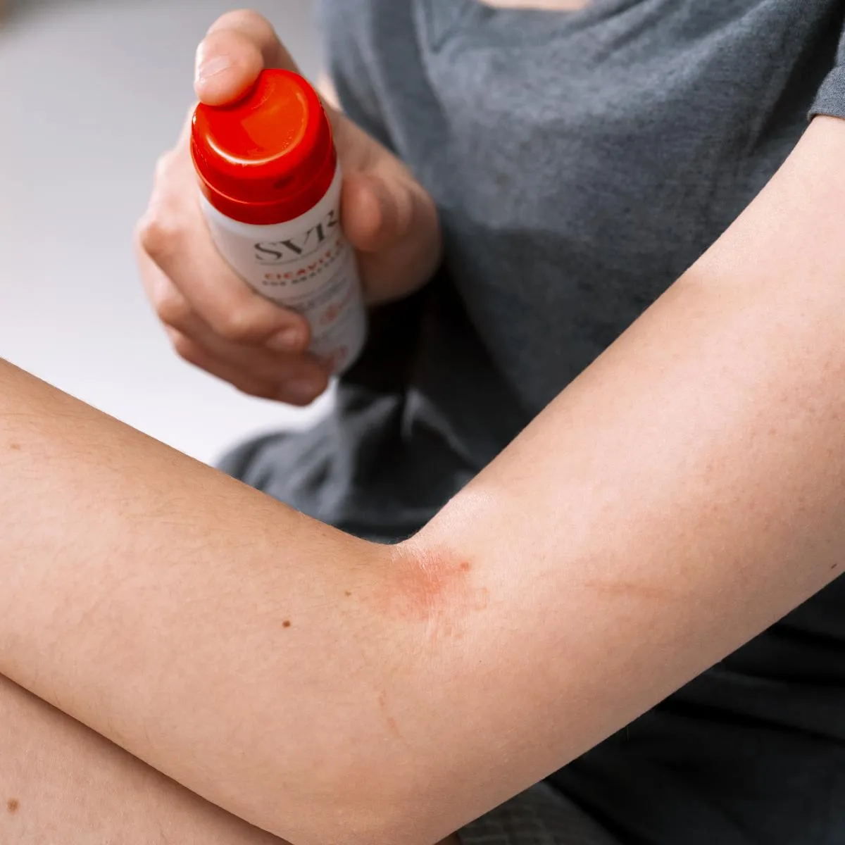 SVR Cicavit+ SOS Grattage spray 40 ml mot klåda