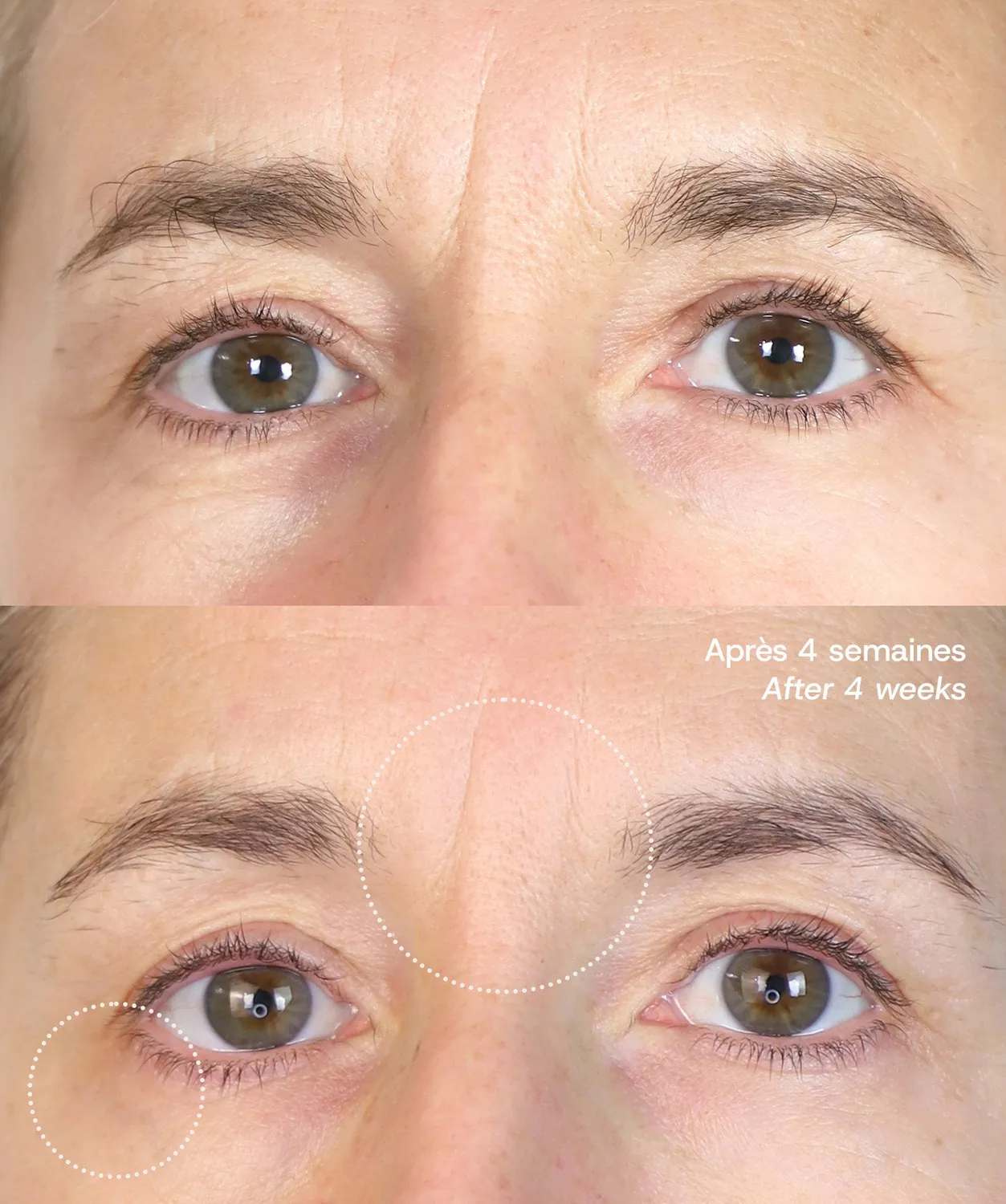 Absolution Le Masque du Temps Redensifiant nattmask mogen